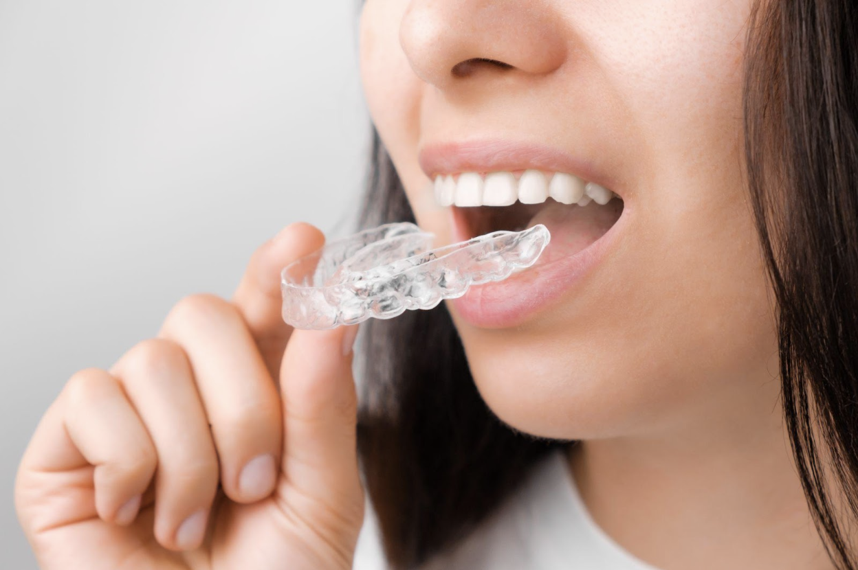 woman putting on invisalign
